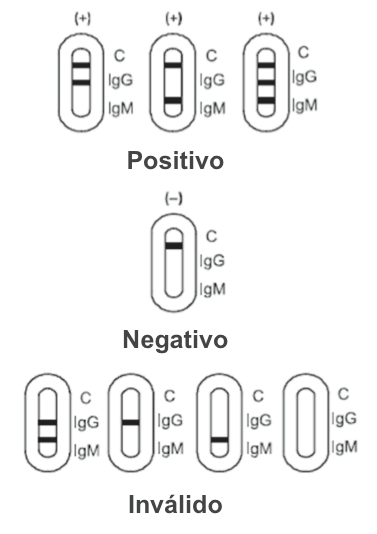 Interpretación de resultados